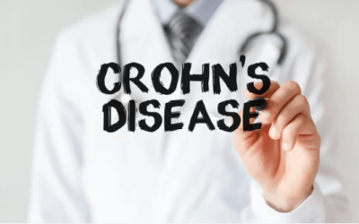 HOW MEDICAL MARIJUANA IS EXCELLENT TO TREAT CROHN’S DISEASE IN FLORIDA?
