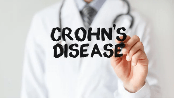 HOW MEDICAL MARIJUANA IS EXCELLENT TO TREAT CROHN’S DISEASE IN FLORIDA?